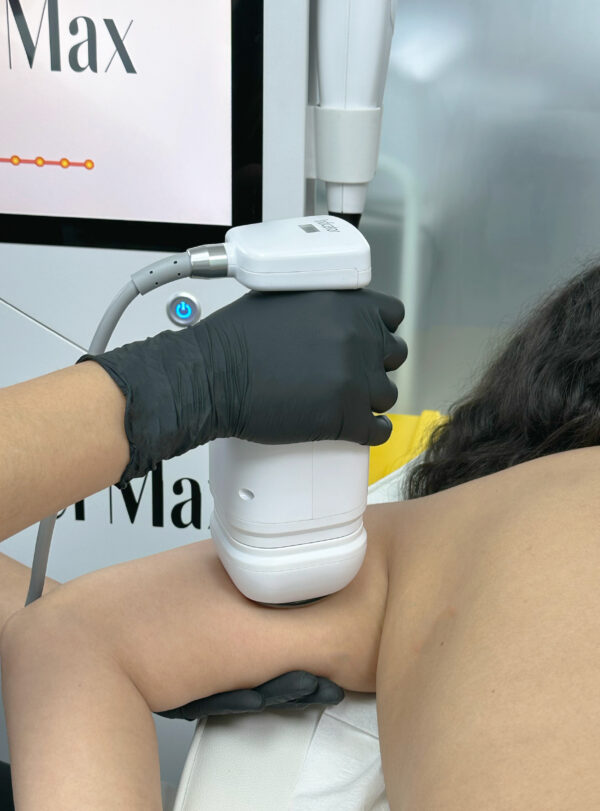Pack HIFU Liposonix en Brazos y Abdomen + Metaloterapia - Image 5