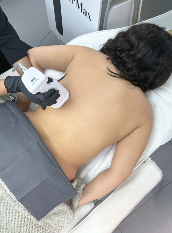 Pack HIFU Liposonix en Brazos y Flancos + Metaloterapia - Image 5