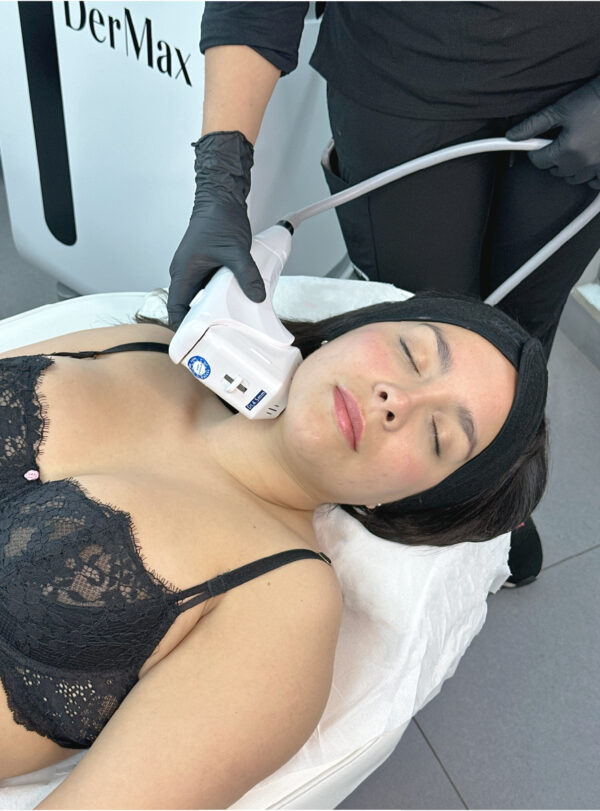 HIFU Facial Completo + Papada - Imagen 2
