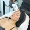 HIFU medio rostro - Imagen 2