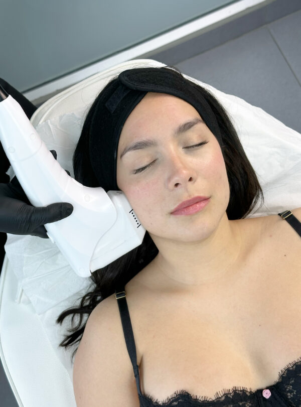 HIFU medio rostro