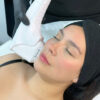HIFU Facial Completo + Papada