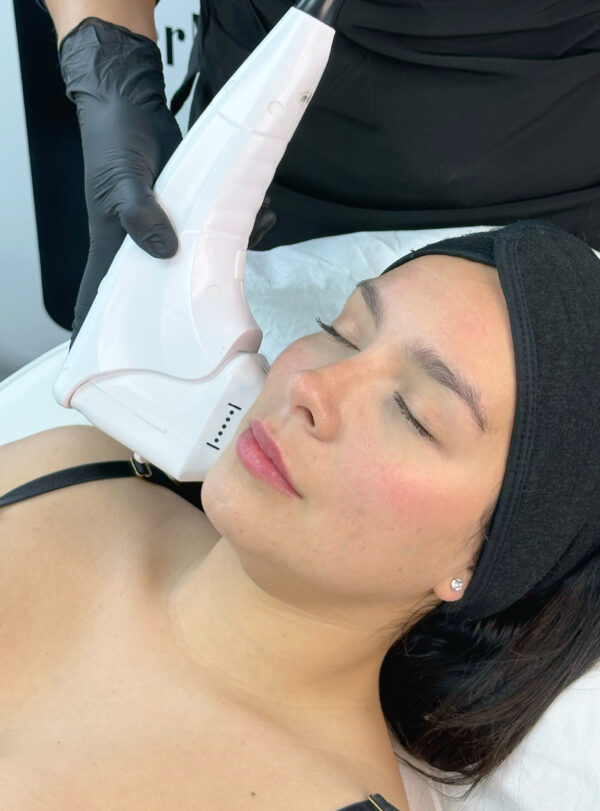 HIFU Facial Completo + Papada