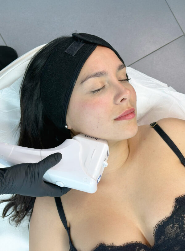 HIFU Facial Completo + Papada + Cuello - Imagen 4