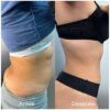 LIPOLAX ABDOMEN Y ESPALDA - Imagen 5