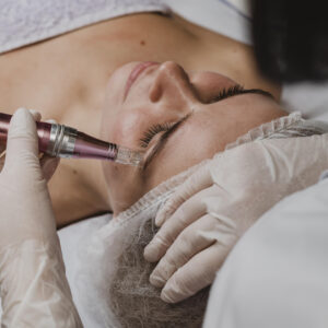 Mesoterapia
